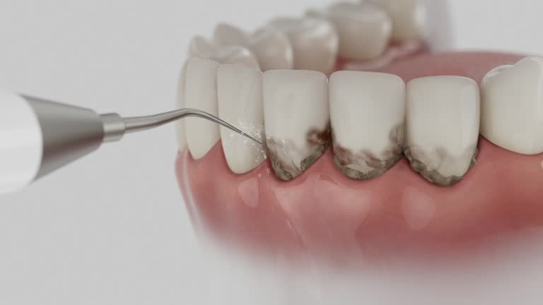 Trusted Dental Implants service in Mooresville, NC - Dentist Open Now